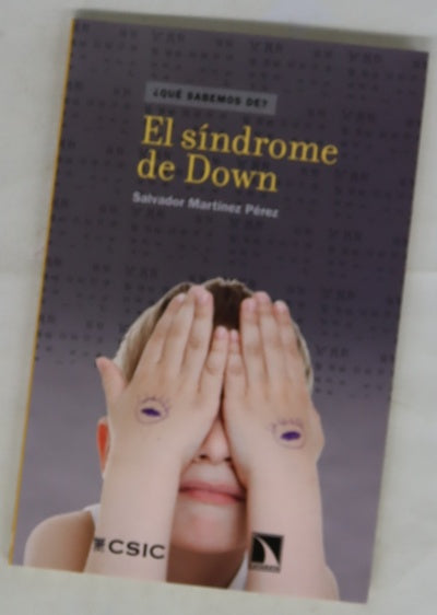 El síndrome de Down