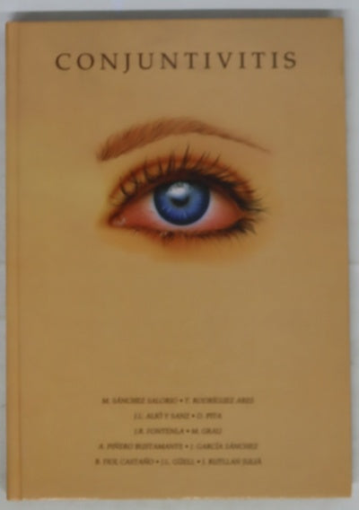 Conjuntivitis