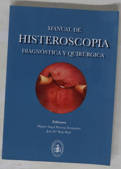 Manual de histeroscopia diagnóstica y quirúrgica