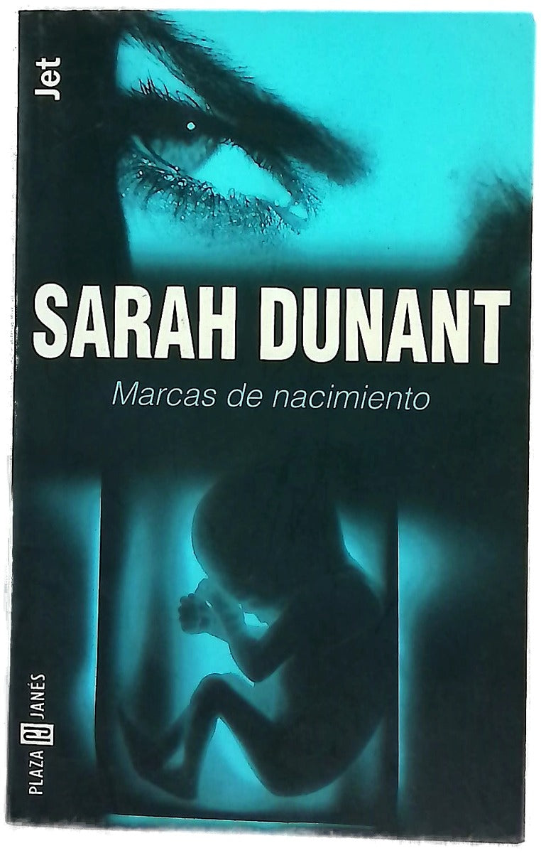 Marcas de nacimiento