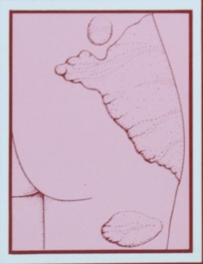 Dermatología para el médico general