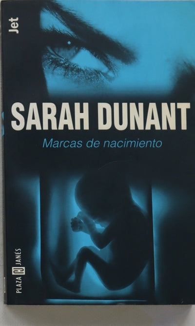 Marcas de nacimiento