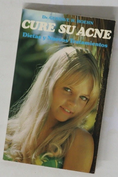 Cure su acné