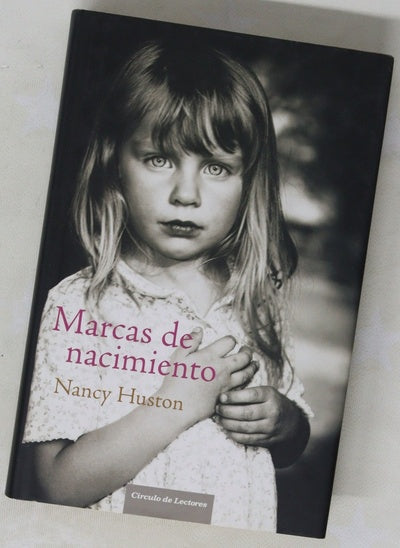 Marcas de nacimiento