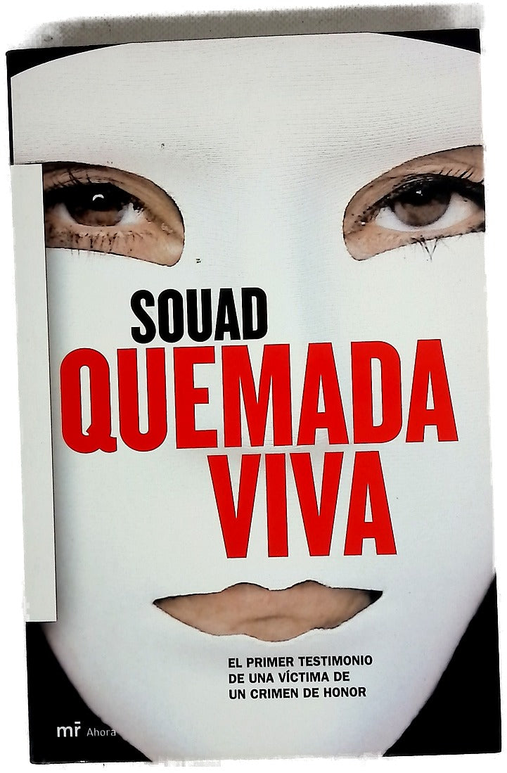 Quemada viva el primer testimonio de una víctima de un crimen de honor